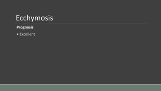 Ecchymosis
Prognosis
• Excellent
 