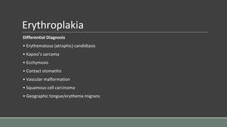 Erythroplakia
Differential Diagnosis
• Erythematous (atrophic) candidiasis
• Kaposi’s sarcoma
• Ecchymosis
• Contact stomatitis
• Vascular malformation
• Squamous cell carcinoma
• Geographic tongue/erythema migrans
 