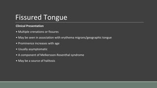 Fissured Tongue
Clinical Presentation
• Multiple crenations or fissures
• May be seen in association with erythema migrans/geographic tongue
• Prominence increases with age
• Usually asymptomatic
• A component of Melkersson-Rosenthal syndrome
• May be a source of halitosis
 