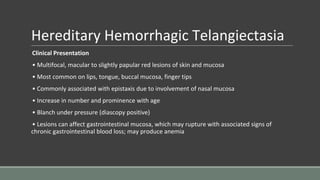 Hereditary Hemorrhagic Telangiectasia
Clinical Presentation
• Multifocal, macular to slightly papular red lesions of skin and mucosa
• Most common on lips, tongue, buccal mucosa, finger tips
• Commonly associated with epistaxis due to involvement of nasal mucosa
• Increase in number and prominence with age
• Blanch under pressure (diascopy positive)
• Lesions can affect gastrointestinal mucosa, which may rupture with associated signs of
chronic gastrointestinal blood loss; may produce anemia
 