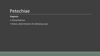 Petechiae
Diagnosis
• Clinical features
• History, determination of underlying cause
 