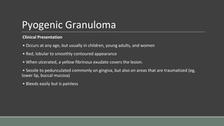 Pyogenic Granuloma
Clinical Presentation
• Occurs at any age, but usually in children, young adults, and women
• Red, lobular to smoothly contoured appearance
• When ulcerated, a yellow fibrinous exudate covers the lesion.
• Sessile to pedunculated commonly on gingiva, but also on areas that are traumatized (eg,
lower lip, buccal mucosa)
• Bleeds easily but is painless
 