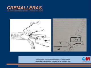 CREMALLERAS.LUIS DOMINGUEZ PEREZ ENFERMERO A. PRIMARIA DAN MADRID
 