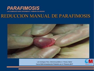 PARAFIMOSISLUIS DOMINGUEZ PEREZ ENFERMERO A. PRIMARIA DAN MADRID
REDUCCION MANUAL DE PARAFIMOSISREDUCCION MANUAL DE PARAFIMOSIS
 