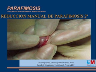 PARAFIMOSISLUIS DOMINGUEZ PEREZ ENFERMERO A. PRIMARIA DAN MADRID
REDUCCION MANUAL DE PARAFIMOSIS 2ªREDUCCION MANUAL DE PARAFIMOSIS 2ª
 