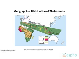 Taleucema Map Comprehensive Overview of Sickle Cell Anaemia: Pathogenesis, Diagnosis ...