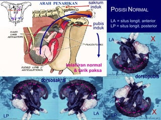 Distokia Sapi (4) Pendahuluan Distokia pada sapi fkh unair | PDF