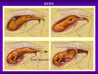 Distokia Sapi (4) Pendahuluan Distokia pada sapi fkh unair | PDF