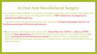In Oral And Maxillofacial Surgery
In a Study by RUKTOWSKI et al ( 2010) used digital radiography and Computer Tomography (CT)
scan analysis to track changes in radiographic density at PRP- treated sites in comparison to
ipsilateral not-PRP treated sites.
The PRP- treated sites demonstrated early and a significant increased radiographic density over
baseline measurements following tooth removal.
In a prospective split-mouth study conducted by Arenaz-Bua et al. (2010) the efficacy of PRP in
promoting bone regeneration after third molar extraction was analyzed. The Authors observed no
further acceleration in bone formation at 6 months nor did they observe statistically significant
differences between the groups regarding pain, swelling, trismus and infection throughout the post-
operative period.
 