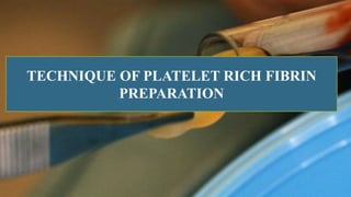 TECHNIQUE OF PLATELET RICH FIBRIN
PREPARATION
 