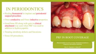 IN PERIODONTICS
• Healing biomaterial in implant and periodontal
surgical procedure.
• Osteo conductive and Osteo inductive properties.
• Good bone fill along with gain in clinical
attachment was seen when PRF was used in
addition to hydroxyapatite.
• Treating intrabony defects and furcations.
• Sinus lift procedures.
PRF IN ROOT COVERAGE
 