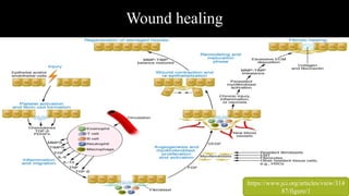 Wound healing
https://www.jci.org/articles/view/314
87/figure/1
 