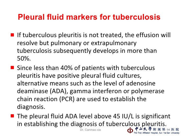4 Pleural Effusions