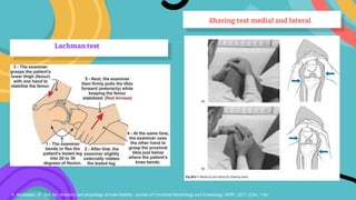 Presentasi Knee Disorders.pptx