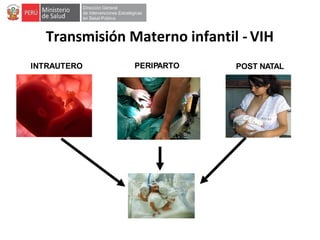 Transmisión Materno infantil - VIH
INTRAUTERO PERIPARTO POST NATAL
 