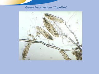Genus Paramecium, “Tupelītes”
 