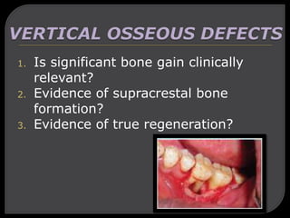 1. Is significant bone gain clinically
relevant?
2. Evidence of supracrestal bone
formation?
3. Evidence of true regeneration?
 