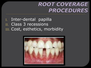 I. Inter-dental papilla
II. Class 3 recessions
III. Cost, esthetics, morbidity
 