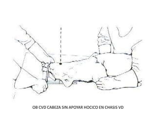 OB CVD CABEZA SIN APOYAR HOCICO EN CHASIS VD
 