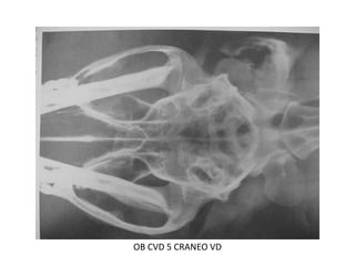 OB CVD 5 CRANEO VD
 