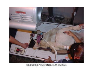 OB CVD RX POSICION BULLAS OSEAS 4
 
