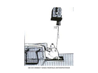 OB CVD CRANEO Y SENOS FRONTALES ANTEROPOSTERIOR
 