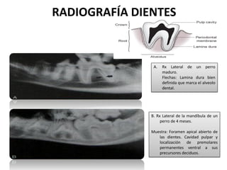RADIOGRAFÍA DIENTES



                A.   Rx Lateral de un perro
                     maduro.
                     Flechas: Lamina dura bien
                     definida que marca el alveolo
                     dental.




               B. Rx Lateral de la mandíbula de un
                    perro de 4 meses.

               Muestra: Foramen apical abierto de
                  las dientes. Cavidad pulpar y
                  localización de premolares
                  permanentes ventral a sus
                  precursores deciduos.
 
