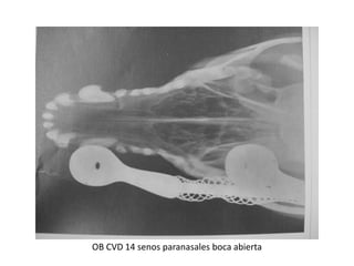 OB CVD 14 senos paranasales boca abierta
 