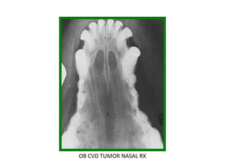 OB CVD TUMOR NASAL RX
 