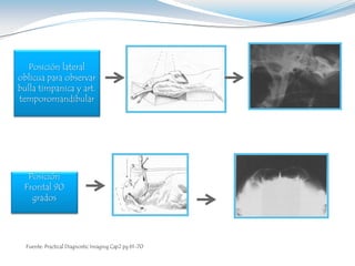 Posición lateral
oblicua para observar
bulla timpanica y art.
temporomandibular




  Posición
 Frontal 90
   grados




  Fuente: Practical Diagnostic Imaging Cap2 pg 61-70
 