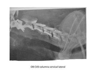 OB CVD columna cervical lateral
 
