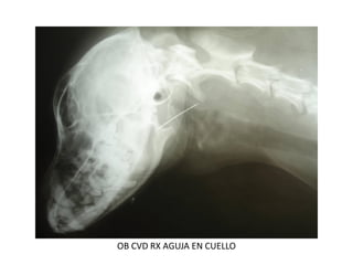 OB CVD RX AGUJA EN CUELLO
 