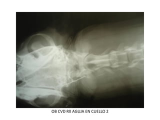 OB CVD RX AGUJA EN CUELLO 2
 