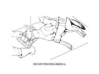 OB CVD POSICION CABEZA LL
 