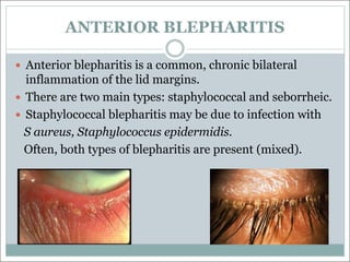 ANTERIOR BLEPHARITIS
— Anterior blepharitis is a common, chronic bilateral
inflammation of the lid margins.
— There are two main types: staphylococcal and seborrheic.
— Staphylococcal blepharitis may be due to infection with
S aureus, Staphylococcus epidermidis.
Often, both types of blepharitis are present (mixed).
 