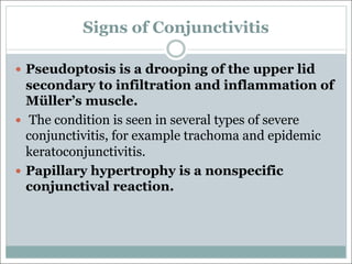Signs of Conjunctivitis
— Pseudoptosis is a drooping of the upper lid
secondary to infiltration and inflammation of
Müller’s muscle.
— The condition is seen in several types of severe
conjunctivitis, for example trachoma and epidemic
keratoconjunctivitis.
— Papillary hypertrophy is a nonspecific
conjunctival reaction.
 