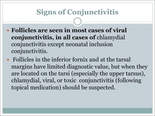 Signs of Conjunctivitis
— Follicles are seen in most cases of viral
conjunctivitis, in all cases of chlamydial
conjunctivitis except neonatal inclusion
conjunctivitis.
— Follicles in the inferior fornix and at the tarsal
margins have limited diagnostic value, but when they
are located on the tarsi (especially the upper tarsus),
chlamydial, viral, or toxic conjunctivitis (following
topical medication) should be suspected.
 