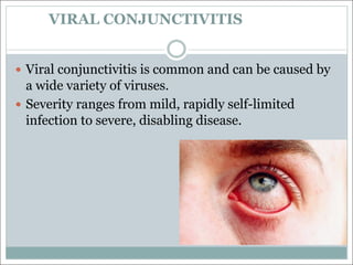 VIRAL CONJUNCTIVITIS
— Viral conjunctivitis is common and can be caused by
a wide variety of viruses.
— Severity ranges from mild, rapidly self-limited
infection to severe, disabling disease.
 