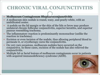 CHRONIC VIRAL CONJUNCTIVITIS
— Molluscum Contagiosum Blepharoconjunctivitis
— A molluscum skin nodule is round, waxy, and pearly-white, with an
umbilicated center.
— A nodule on the lid margin or the skin of the lids or brow may produce
unilateral chronic follicular conjunctivitis, superior keratitis, and superior
pannus resembling trachoma.
— The inflammatory reaction is predominantly mononuclear (unlike the
reaction in trachoma).
— Excision or even incision of the nodule, thus allowing peripheral blood to
permeate it, or cryotherapy cures the conjunctivitis.
— On very rare occasions, molluscum nodules have occurred on the
conjunctiva. In these cases, excision of the nodule has also relieved the
conjunctivitis.
— Multiple lid or facial lesions of molluscum contagiosum occur in patients
with acquired immunodeficiency syndrome (AIDS).
 