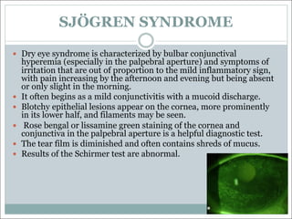 SJÖGREN SYNDROME
— Dry eye syndrome is characterized by bulbar conjunctival
hyperemia (especially in the palpebral aperture) and symptoms of
irritation that are out of proportion to the mild inflammatory sign,
with pain increasing by the afternoon and evening but being absent
or only slight in the morning.
— It often begins as a mild conjunctivitis with a mucoid discharge.
— Blotchy epithelial lesions appear on the cornea, more prominently
in its lower half, and filaments may be seen.
— Rose bengal or lissamine green staining of the cornea and
conjunctiva in the palpebral aperture is a helpful diagnostic test.
— The tear film is diminished and often contains shreds of mucus.
— Results of the Schirmer test are abnormal.
 