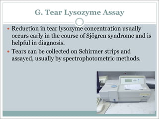 G. Tear Lysozyme Assay
— Reduction in tear lysozyme concentration usually
occurs early in the course of Sjögren syndrome and is
helpful in diagnosis.
— Tears can be collected on Schirmer strips and
assayed, usually by spectrophotometric methods.
 