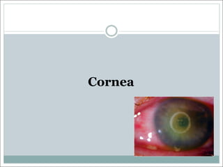 Cornea
 