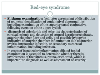 Red-eye syndrome
— Slitlamp examination facilitates assessment of distribution
of redness; identification of conjunctival abnormalities,
including examination of the superior tarsal conjunctiva
following eversion of the upper eyelid;
— diagnosis of episcleritis and scleritis; characterization of
corneal lesions; and detection of corneal keratic precipitates,
anterior chamber flare and cells, and possibly hypopyon
indicative of anterior chamber inflammation due to anterior
uveitis, intraocular infection, or secondary to corneal
inflammation, including infection.
— In cases of intraocular inflammation, dilated fundal
examination is essential to determine whether there is
involvement of the vitreous, retina, or choroid, which is
important to diagnosis as well as assessment of severity.
 