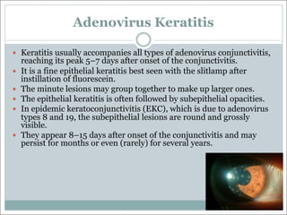 Adenovirus Keratitis
— Keratitis usually accompanies all types of adenovirus conjunctivitis,
reaching its peak 5–7 days after onset of the conjunctivitis.
— It is a fine epithelial keratitis best seen with the slitlamp after
instillation of fluorescein.
— The minute lesions may group together to make up larger ones.
— The epithelial keratitis is often followed by subepithelial opacities.
— In epidemic keratoconjunctivitis (EKC), which is due to adenovirus
types 8 and 19, the subepithelial lesions are round and grossly
visible.
— They appear 8–15 days after onset of the conjunctivitis and may
persist for months or even (rarely) for several years.
 
