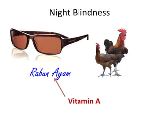 Night Blindness




Rabun Ayam

         Vitamin A
 