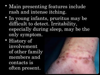 4_Scabies_Lucy.pptxbuat syarat presentasi okeh | PPTX