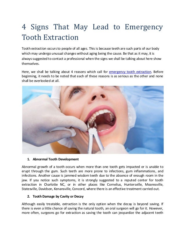 4 Signs That May Lead To Emergency Tooth Extraction