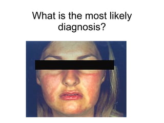 What is the most likely
     diagnosis?
 
