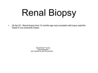 Renal Biopsy
•   24 Apr 07 - Renal biopsy from 13 months ago was consistent with lupus nephritis
    Class IV (no crescents noted).




                               QuickTime™ and a
                                decompressor
                        are needed to see this picture.
 