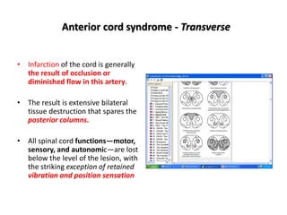 Cord Infarct Pattern 4 spinal cord ds.pptx